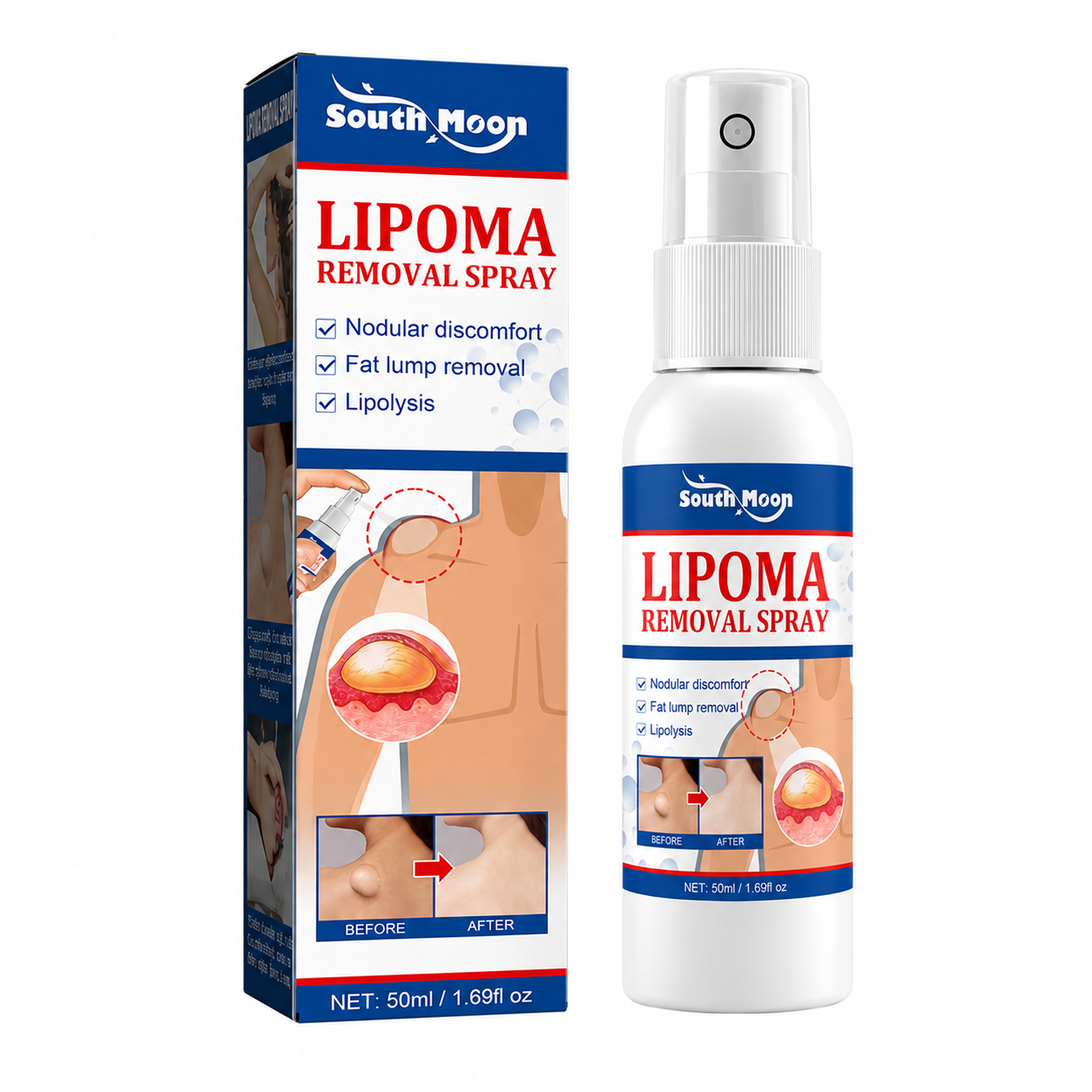 Spray Reductor de Lipomas y Bultos de Grasa
